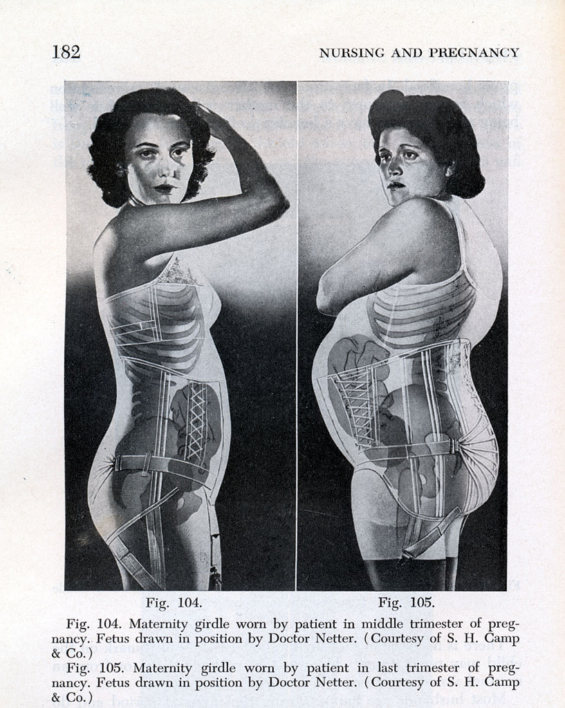 Diagram of maternity girdles, with x-ray filters showing the inside of each woman's body.