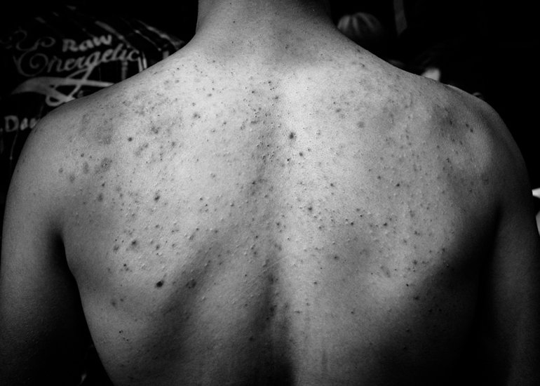 Picture of a teen boy.